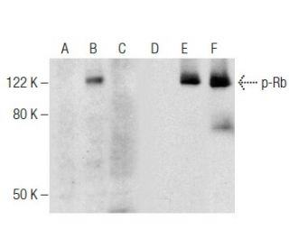 p-Rb Antibody (F-4) - Western Blotting - Image 284456