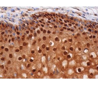 immunohistochemistry image from recommended p-Rb (A-5) monoclonal antibody replacement. Image 286536