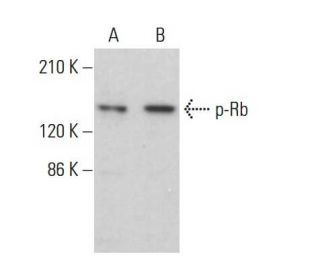 western blotting image from recommended p-Rb (B-4) monoclonal antibody replacement. Image 375363