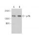 western blotting image from recommended p-Rb (B-4) monoclonal antibody replacement. Image 375363