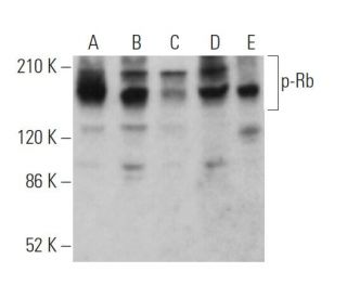 western blotting image from recommended p-Rb (E-10) monoclonal antibody replacement. Image 370876