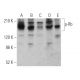 western blotting image from recommended p-Rb (E-10) monoclonal antibody replacement. Image 370876