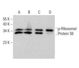 p-Ribosomal Protein S6 Antibody (51.Ser 244) - Western Blotting - Image 377244 