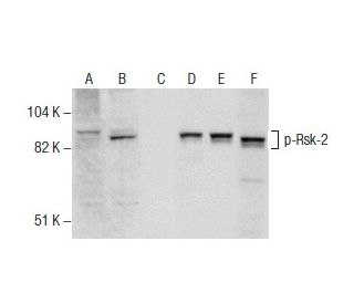 western blotting image from recommended p-Rsk-2 (C-6) monoclonal antibody replacement. Image 157435
