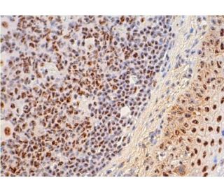 p-SC35 Antibody (SC-35) - Immunohistochemistry - Image 384087 