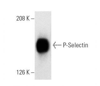 P-Selectin/CD62P/SELP Antibody (1 E 3) - Western Blotting - Image 5275 