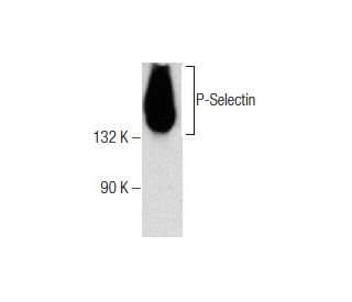 P-Selectin/CD62P/SELP Antibody (AK4) - Western Blotting - Image 159009 