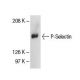 western blotting image from recommended P-Selectin/CD62P/SELP (CTB201) monoclonal antibody replacement. Image 5277