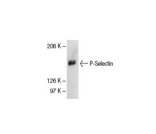 western blotting image from recommended P-Selectin/CD62P/SELP (CTB201) monoclonal antibody replacement. Image 5277
