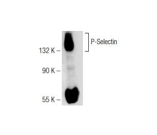 P-Selectin/CD62P/SELP Antibody (Psel.KO.2.9) - Western Blotting - Image 126452