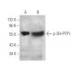 p-SH-PTP1 Antibody (14.Tyr 536) - Western Blotting - Image 375128