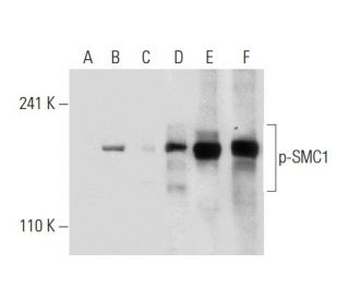 p-SMC1 Antibody (5D11G5) - Western Blotting - Image 133087 
