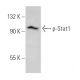 western blotting image from recommended p-Stat1 (PSM1) monoclonal antibody replacement. Image 366609