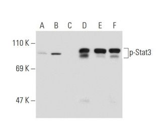 p-Stat3 Antibody (6D779) - Western Blotting - Image 133920 