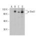 western blotting image from recommended p-Stat3 (pS727.25) monoclonal antibody replacement. Image 400936