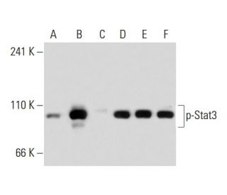 western blotting image from recommended p-Stat3 (B-7) monoclonal antibody replacement. Image 134828