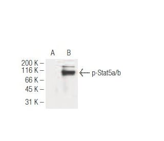 western blotting image from recommended p-Stat5a/b (5G4) monoclonal antibody replacement. Image 62941