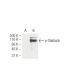 western blotting image from recommended p-Stat5a/b (5G4) monoclonal antibody replacement. Image 62941