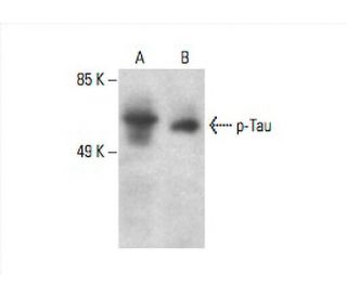 western blotting image from recommended p-Tau (PHF-13) monoclonal antibody replacement. Image 393058