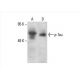 western blotting image from recommended p-Tau (PHF-13) monoclonal antibody replacement. Image 393058