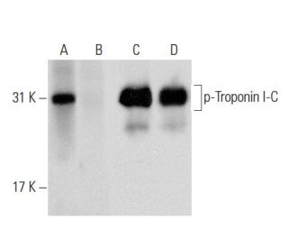 p-Troponin I-C Antibody (1G11) - Western Blotting - Image 135383