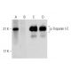 p-Troponin I-C Antibody (1G11) - Western Blotting - Image 135383