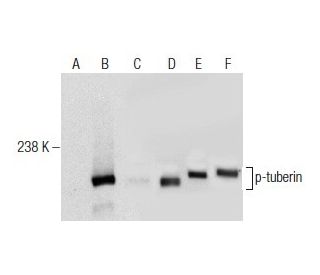 p-tuberin Antibody (325.Ser 1798) - Western Blotting - Image 164508 