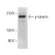 p-tuberin Antibody (325.Ser 1798) - Western Blotting - Image 378449