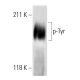 Phosphotyrosine Antibody (P-Tyr-01) - Western Blotting - Image 12679