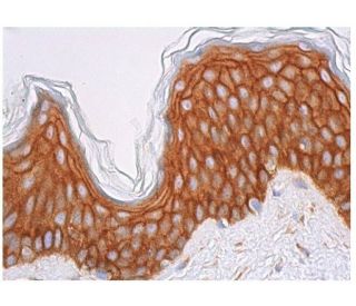 immunohistochemistry image from recommended Phosphotyrosine (PY99) monoclonal antibody replacement. Image 348953