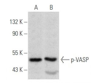 p-VASP Antibody (A-7) - Western Blotting - Image 354859 