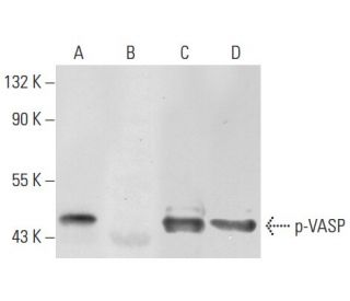 western blotting image from recommended p-VASP (16C2) monoclonal antibody replacement. Image 72649