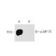 p-ZAP-70 Antibody (pY319.17A) - Western Blotting - Image 127555