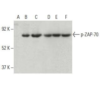 p-ZAP-70 Antibody (pY319.17A) - Western Blotting - Image 396645 