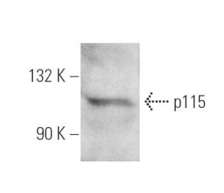 p115 Antibody (5D6) - Western Blotting - Image 4073 