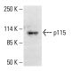 p115 Antibody (5D6) - Western Blotting - Image 413006