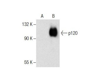 p120 Antibody (A-8) - Western Blotting - Image 287802