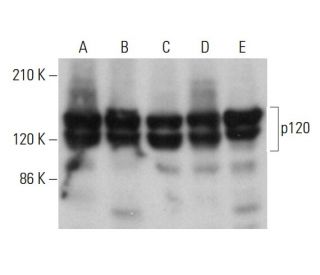 p120 Antibody (G-7) - Western Blotting - Image 376130 