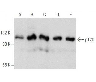 western blotting image from recommended p120 (6H11) monoclonal antibody replacement. Image 354731