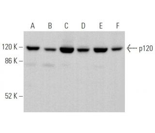p120 Antibody (6H11) - Western Blotting - Image 373934 