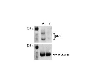p120 siRNA (h): sc-36139. Western blot analysis of p120 expression in non-transfected control (A) and p120 siRNA transfect 