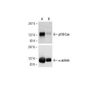p130 Cas siRNA (h): sc-36141. Western blot analysis of p130 Cas expression in non-transfected control (A) and p130 Cas siR 