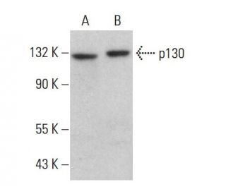 p130 Antibody (F-8) - Western Blotting - Image 380229Each CRISPR/Cas9 Knockout (KO) Plasmid product consists of a pool of 3 plasmids designed to ensure identification and cleavage of a specific gene for maximum knockout efficiency. Each plasmid encodes a unique 20 nt sequence derived from the GeCKO (v2) library.