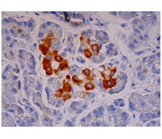 p14ARF Antibody (14P02 ) - Immunohistochemistry - Image 347930 