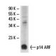 p14ARF Antibody (3F16) - Western Blotting - Image 18143