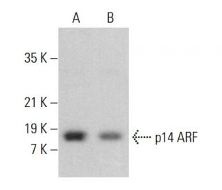 p14ARF Antibody (3F16) - Western Blotting - Image 379626 