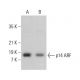 p14ARF Antibody (3F16) - Western Blotting - Image 379626 