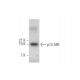 western blotting image from recommended p14ARF (ARF 4C6/4) monoclonal antibody replacement. Image 349907