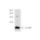 p14ARF Antibody (DCS-240) - Western Blotting - Image 14586