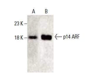 p14ARF Antibody (DCS-240) - Western Blotting - Image 397970 